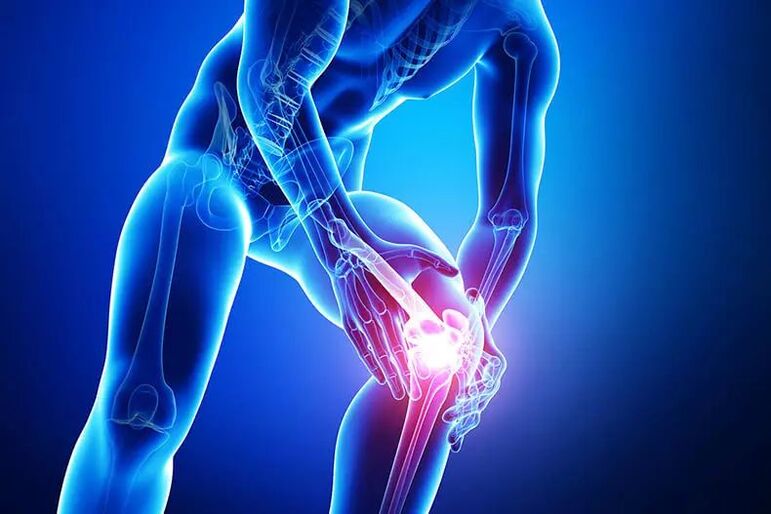 comharthaí arthrosis