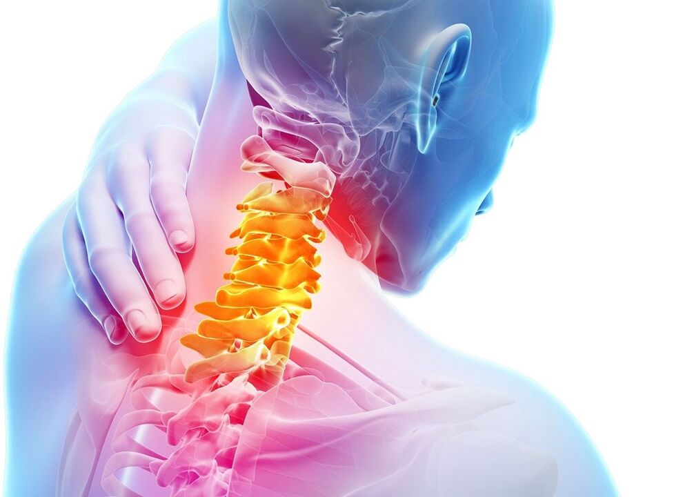 osteochondrosis an spine cheirbheacsach